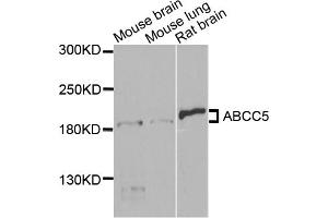 Western blot analysis of extracts of various cell lines, using ABCC5 antibody (ABIN5971551) at 1/1000 dilution. (ABCC5 抗体)