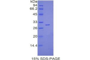 SDS-PAGE analysis of Mouse Lymphocyte Antigen 9 Protein. (LY9 蛋白)