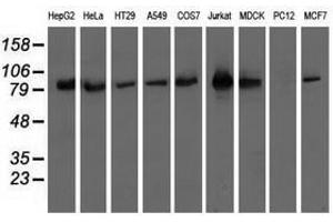 Image no. 2 for anti-Oxysterol Binding Protein-Like 11 (OSBPL11) antibody (ABIN1499922) (OSBPL11 抗体)