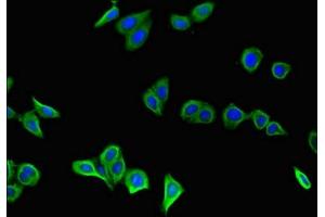 Immunofluorescent analysis of HepG2 cells using ABIN7154085 at dilution of 1:100 and Alexa Fluor 488-congugated AffiniPure Goat Anti-Rabbit IgG(H+L) (GSTA1 抗体  (AA 2-222))