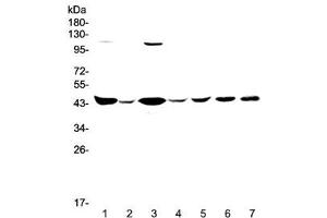 Western blot testing of human 1) HeLa, 2) placenta, 3) COLO-320, 4) SW620, 5) MDA-MB-231, 6) rat brain and 7) mouse brain lysate with CKB antibody at 0. (CKB 抗体)