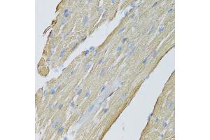 Immunohistochemistry of paraffin-embedded mouse heart using CKMT2 antibody (ABIN5975698) at dilution of 1/100 (40x lens). (CKMT2 抗体)