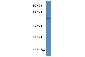 Western Blotting (WB) image for anti-Cytochrome P450, Family 51, Subfamily A, Polypeptide 1 (CYP51A1) (N-Term) antibody (ABIN2788354)