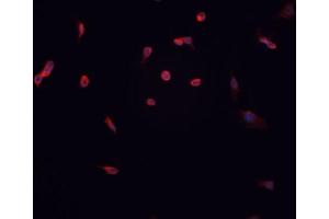 ABIN6267057 staining HT-1080 cells by IF/ICC. (Cyclin D1 抗体  (pThr286))