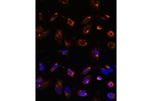 Immunofluorescence analysis of U-2 OS cells using LRRFIP2 antibody (ABIN7268214) at dilution of 1:100. (LRRFIP2 抗体  (AA 150-340))
