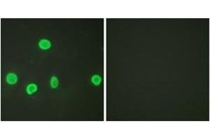 Immunofluorescence analysis of HeLa cells, using Histone H3 (Acetyl-Lys18) Antibody. (Histone 3 抗体  (H3K18ac))