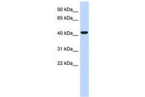 Image no. 1 for anti-Sphingomyelin Synthase 2 (SGMS2) (AA 71-120) antibody (ABIN6741219) (Sphingomyelin Synthase 2 抗体  (AA 71-120))