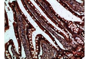 Immunohistochemical analysis of paraffin-embedded human-small-intestine, antibody was diluted at 1:200 (FABP2 抗体  (AA 90-132))