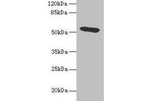 Western blot All lanes: Hpx antibody at 4. (Hemopexin 抗体  (AA 24-460))