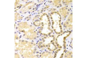 Immunohistochemistry of paraffin-embedded human kidney using S100A11 antibody. (S100A11 抗体  (AA 1-105))