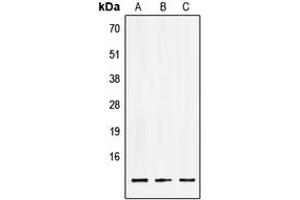 Western blot analysis of LSM2 expression in HEK293T (A), NIH3T3 (B), PC12 (C) whole cell lysates. (LSM2 抗体  (Center))