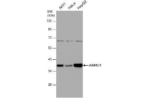 WB Image Various whole cell extracts (30 μg) were separated by 10% SDS-PAGE, and the membrane was blotted with AKR1C1 antibody , diluted at 1:1000. (AKR1C1 抗体)