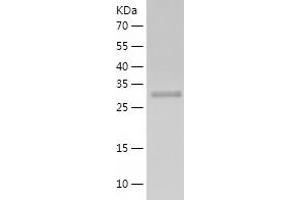 Western Blotting (WB) image for Aryl Hydrocarbon Receptor Interacting Protein (AIP) (AA 1-330) protein (His tag) (ABIN7121901)