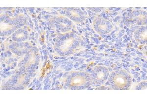 Detection of HBb in Mouse Uterus Tissue using Polyclonal Antibody to Hemoglobin Beta (HBb) (Hemoglobin Subunit beta 抗体  (AA 1-147))