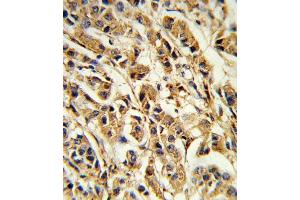 Immunohistochemistry (Paraffin-embedded Sections) (IHC (p)) image for anti-Sterol Regulatory Element Binding Transcription Factor 1 (SREBF1) (AA 349-378) antibody (ABIN652680)
