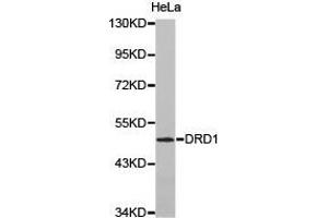 Western Blotting (WB) image for anti-Dopamine Receptor D1 (DRD1) antibody (ABIN1872351) (Dopamine Receptor d1 抗体)