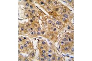 Image no. 2 for anti-Angiotensinogen (serpin Peptidase Inhibitor, Clade A, Member 8) (AGT) (N-Term) antibody (ABIN360211)