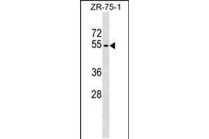 Western blot analysis in ZR-75-1 cell line lysates (35ug/lane). (Phospholipase D4 抗体  (N-Term))