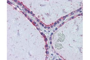 Immunohistochemistry with HeLa, Vera, HeLa transfected with mouse construct tissue (KIF20A 抗体  (Middle Region))