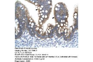 Human Intestine (TFB2M 抗体  (N-Term))