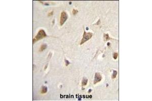 Immunohistochemistry (Paraffin-embedded Sections) (IHC (p)) image for anti-Zinc Finger, MYND-Type Containing 10 (ZMYND10) (AA 321-348) antibody (ABIN656033)