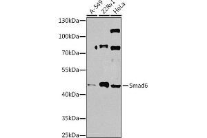 Western blot analysis of extracts of various cell lines, using Smad6 antibody (ABIN7270355) at 1:1000 dilution. (SMAD6 抗体  (AA 257-496))