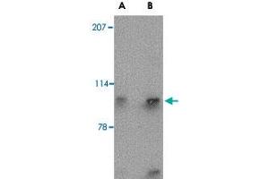 Western blot analysis of SLITRK4 in mouse brain tissue lysate with SLITRK4 polyclonal antibody  at (A) 0. (SLITRK4 抗体  (N-Term))