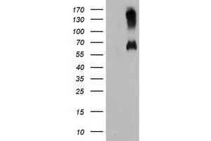 Western Blotting (WB) image for anti-Chromosome 18 Open Reading Frame 8 (C18orf8) antibody (ABIN1497027) (C18orf8 抗体)