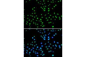 Immunofluorescence analysis of MCF-7 cells using NAT10 antibody (ABIN5974394).