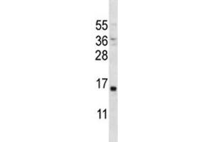 PTH antibody western blot analysis in MDA-MB231 lysate. (PTH 抗体  (AA 59-88))