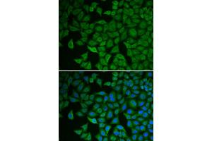 Immunofluorescence analysis of HeLa cells using CHEK2 antibody. (CHEK2 抗体)