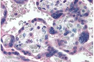 Human Placenta (formalin-fixed, paraffin-embedded) stained with TP73 antibody ABIN290399 at 5 ug/ml followed by biotinylated anti-mouse IgG secondary antibody ABIN481714, alkaline phosphatase-streptavidin and chromogen. (Tumor Protein p73 抗体  (AA 2-13))