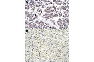 Immunohistochemical staining (Formalin-fixed paraffin-embedded sections) of human muscle (A) and human heart (B) with GTF2H3 polyclonal antibody  at 4-8 ug/mL working concentration. (GTF2H3 抗体  (N-Term))