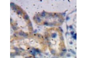 Used in DAB staining on fromalin fixed paraffin-embedded Kidney tissue (ADAMTS1 抗体  (AA 855-968))