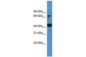 Image no. 1 for anti-Activating Signal Cointegrator 1 Complex Subunit 1 (ASCC1) (AA 261-310) antibody (ABIN6746472) (ASCC1 抗体  (AA 261-310))