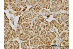 Immunoperoxidase of monoclonal antibody to CENPJ on formalin-fixed paraffin-embedded human pancreas. (CENPJ 抗体  (AA 979-1088))