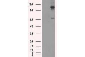 Image no. 2 for anti-L1 Cell Adhesion Molecule (L1CAM) antibody (ABIN1499088) (L1CAM 抗体)