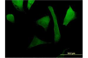 Immunofluorescence (IF) image for anti-Ras-Related C3 Botulinum Toxin Substrate 2 (Rho Family, Small GTP Binding Protein Rac2) (RAC2) (AA 1-192) antibody (ABIN519594)