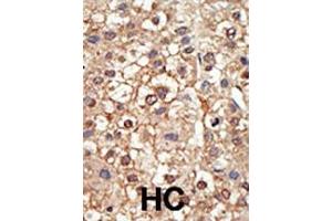 Immunohistochemistry (Paraffin-embedded Sections) (IHC (p)) image for anti-Protein Inhibitor of Activated STAT, 4 (PIAS4) (AA 48-79), (N-Term) antibody (ABIN388061)