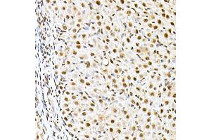 Immunohistochemistry of paraffin-embedded rat ovary using ID2 Rabbit pAb (ABIN3021261, ABIN3021262, ABIN3021263 and ABIN6214091) at dilution of 1:50 (40x lens). (Id2 抗体  (AA 75-134))
