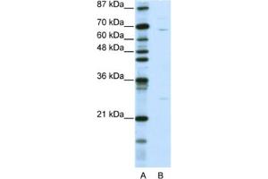 Western Blotting (WB) image for anti-Kelch-Like 13 (KLHL13) antibody (ABIN2461016) (KLHL13 抗体)