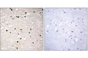 Immunohistochemistry analysis of paraffin-embedded human brain tissue, using p73 antibody. (Tumor Protein p73 抗体  (Internal Region))