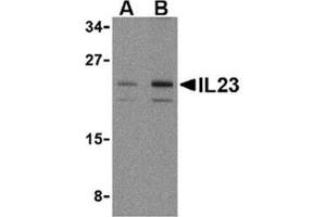 Image no. 1 for anti-Interleukin 23, alpha subunit p19 (IL23A) (N-Term) antibody (ABIN318745) (IL23A 抗体  (N-Term))