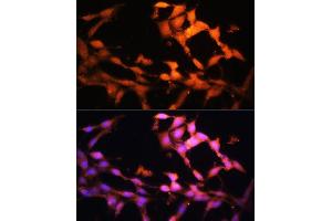 Immunofluorescence analysis of NIH/3T3 cells using FLCN antibody (ABIN7267226) at dilution of 1:100. (FLCN 抗体  (AA 1-130))