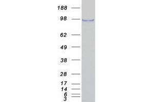 Western Blotting (WB) image for RNA Binding Motif Protein 5 (RBM5) protein (Myc-DYKDDDDK Tag) (ABIN2730624)