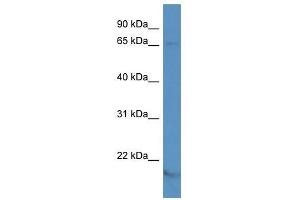 Western Blotting (WB) image for anti-Potassium Voltage-Gated Channel, Shaker-Related Subfamily, Member 5 (KCNA5) (N-Term) antibody (ABIN927470)
