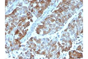 Immunohistochemistry (IHC) image for anti-Tumor Necrosis Factor Receptor Superfamily, Member 4 (TNFRSF4) (AA 59-205) antibody (ABIN6940817)