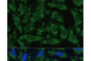 Immunofluorescence (IF) image for anti-Enolase 1 (ENO1) antibody (ABIN7259410)