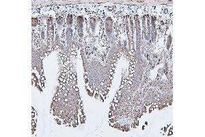 IHC analysis of CALR using anti-CALR antibody (ABIN7600329). (Calreticulin 抗体  (AA 18-323))