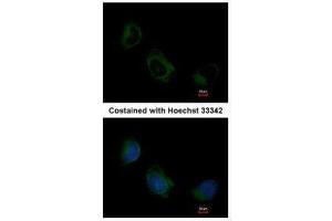 ICC/IF Image Immunofluorescence analysis of methanol-fixed HeLa, using EIF3F, antibody at 1:200 dilution. (EIF3F 抗体)